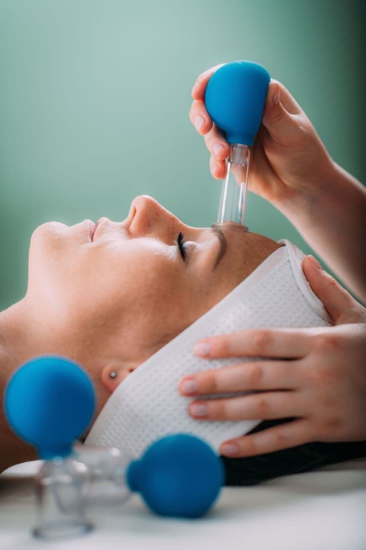 Facial Cupping