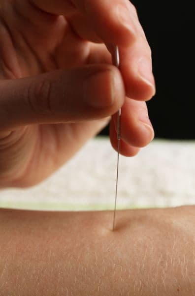 Traditional Chinese Medicine services